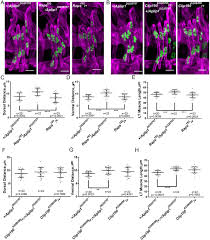 Similarly, simulation of a series of cyclical contractions predicted a 1.34 times higher maximum power output from chimpanzee the two musculoskeletal models include all of the same muscles, except that the human model lacks an m. Aplip1 The Drosophila Homolog Of Jip1 Regulates Myonuclear Positioning And Muscle Stability Journal Of Cell Science