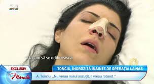Andreea tonciu, nas, operatie estetica, sexy, data: Imagini De Cosmar Ce S A Intamplat Cu Andreea Tonciu Inainte De Operatia La Nas Si Cum Arata Bruneta Imediat Dupa Interventie Cancan Ro
