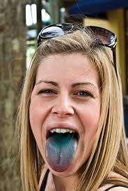 Florida 2009 Steph comes down with blue-tongue