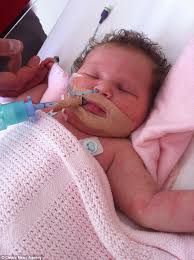 Baby the size of a toddler has Beckwith Wiedemann Syndrome and  hyperinsulinism