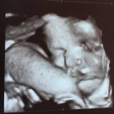 See full list on pampers.com How Much Did Your Baby Weigh At 34 Weeks Glow Community