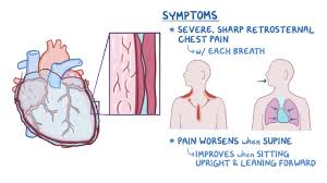 The visceral layer that adheres to epicardial surface of the heart, and the parietal layer that surrounds most of the heart. Pericardial Disease Clinical Practice Osmosis