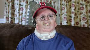 Jeff is diagnosed with Nager syndrome. He hopes that instead of staring you  take the time to talk to him about "sports, animals and Disney."