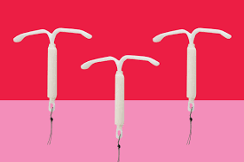 iud side effects a love story