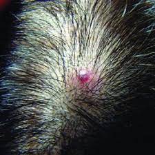 Maybe you would like to learn more about one of these? Rui Tavares Bello S Research Works Lusiadas Hospital Lisbon Hpplusiadas And Other Places