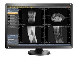 I'm excited to have found somewhere that i feel confident going for my medical needs, and i will be recommending them to friends and family Del Medical Evoview Pacs Radiology Imaging Solutions