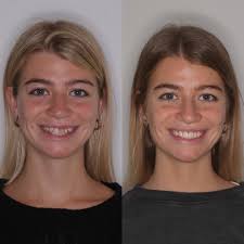 🌟 ¡Hola a todos! 🌟 Queremos presentarles al licenciado que nos acompaña  en el área de Psicología desde hace un tiempo. El es: 👨‍⚕️ **Licenciado  Mariano Pennisi** Estamos muy agradecidos por su