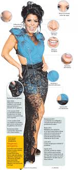 Alejandra guzmán botox alejandra guzman cambio estético alejandra guzman cirugía estética alejandra guzman cirugia estetica famosas mexicanas. Alejandra Guzman En Tratamiento Medico De Por Vida Alejandra Guzman Laguzman Com