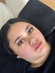 Has anyone lost an injured cat