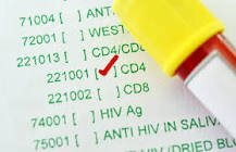 Image result for what happens to viral load if treatment is successfully begun?