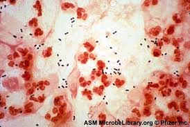 Image result for CSF Gram Stain