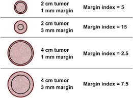 Watch the full episode from brighteon.com here: Margin Index A Useful Tool For The Breast Surgeon Sciencedirect