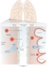 Pdf Clinical Aspects Of Pleural Fluid Ph October 2009 Semantic Scholar