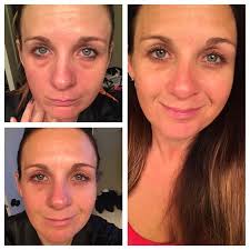 Pin von Michelle Collin auf Skin Care