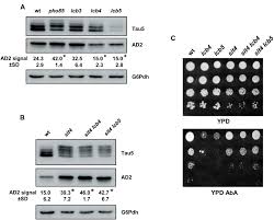 Maybe you would like to learn more about one of these? Frontiers Sphingolipids And Inositol Phosphates Regulate The Tau Protein Phosphorylation Status In Humanized Yeast Cell And Developmental Biology