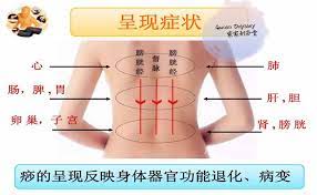 Include (or exclude) self posts. åˆ®ç—§å°è´´å£« åˆ®ç—§å¥½å¤„å¤š ä¹Ÿè®¸æ‚¨å¬è¿‡ åˆ®ç—§ ä½†æ˜¯ æ‚¨äº†è§£åˆ®ç—§å— Guasa Odyssey å®¶å®¶åˆ®ç—§å ‚ Facebook