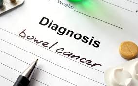 Although bowel cancer affects people of all ages, it is common in people aged 60 years and above, and is one. Maori Disappointed Bowel Screening Age Will Not Be Lowered Rnz News