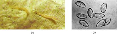 Picking and removing biggest itchy flaky with a lot of black worm on top head #84. Helminthic Infections Of The Gastrointestinal Tract Microbiology