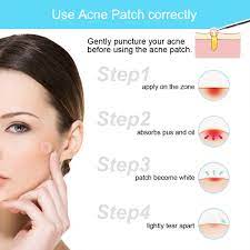 You apply the patch on freshly cleansed and toned skin once the acne has come to head with a bit of white pus. Best Hydrocolloid Acne Pimple Patch Acne Stickers