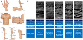 Image result for Edema Exam