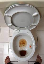 My dog has an unusual talent. 425 Vomit Toilet Photos Free Royalty Free Stock Photos From Dreamstime