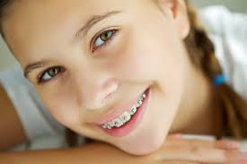 While some electric toothbrushes provide several brushing modes or speeds for different applications, other come with only one mode. How Can I Brush And Floss My Teeth If I Wear Braces Or A Retainer Luba Richter Orthodontics
