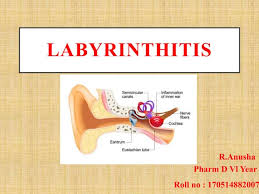 Image result for Bacterial Labyrinthitis