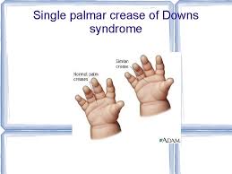 Über 7 millionen englischsprachige bücher. The Bones Of The Hand Capitate By 2