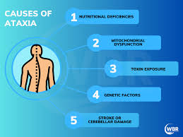 Image result for Ataxia