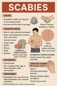 Image result for scabies symptoms