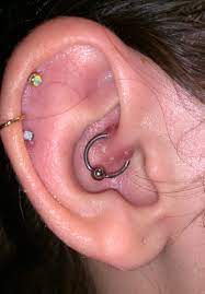 First Ever Keloids Help Piercing