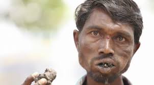 .kaki ayam asap orang tidak banyak bicara, katakan padaku apa yang ingin mereka makan. Selama 20 Tahun Pria Ini Kecanduan Makan Batu Bata Dan Lumpur Citizen6 Liputan6 Com