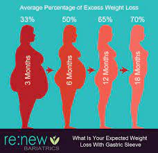 After having gastric sleeve surgery, the resulting weight loss is significant and tends to happen quickly after having surgery. Pin On Sleeve Surgery