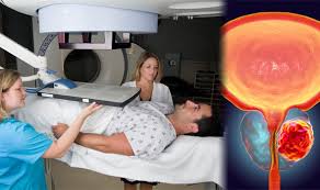 It can kill cancer cells and shrink a tumor. Prostate Cancer Treatment Time Slashed To Under Three Weeks Express Co Uk