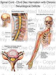 Pin On 4 Health