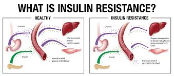 However you manage your diabetes, stay in the know about your blood sugar levels. Understanding Blood Sugar Balance Insulin Resistance Natures Aid