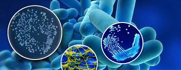 Legionnaires' disease is a serious type of pneumonia caused by legionella bacteria. What Is Legionnaire S Disease Water Treatment Wales