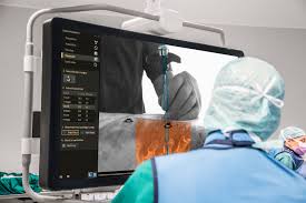 Image result for Innovations in Field of Spinal Technology