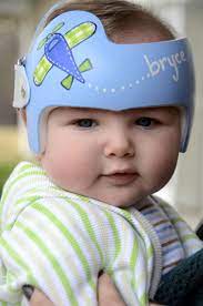 Pin By Leigh Gibson On Cranial Bands Helmets Doc Band Baby Helmet Baby Helmet Design