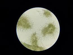 Image result for Chlorosplenium chlora