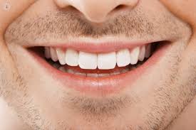 A top dentist opens up about what he wishes his patients would do. The Different Types Of Cosmetic Dentistry Top Doctors