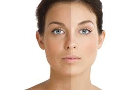 This article explains what can be done about abnormal pigmentation. Skin Pigmentation Dermatox Skin Clinic