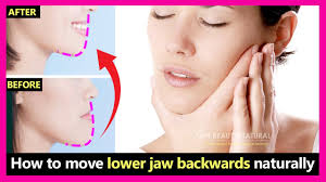 Your child should avoid or cut. How To Fix Underbite Protruding Jaw Move Lower Jaw Backwards Naturally Prognathism Jaw Exercises Youtube