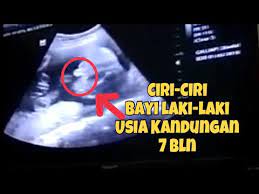 Oleh karenanya, tingkat kesalahan identifikasi janin perempuan lebih besar daripada janin laki2. Ciri Ciri Bayi Laki Laki Dilihat Dari Usg Umur Kandungan 7 Bulan Youtube