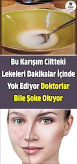 Bu Karisim Ciltteki Lekeleri Dakikalar Icinde Yok Ediyor Doktorlar Bile Soke Oluyor Dunya Capindaki Herk Dogal Cilt Bakimi Dogal Guzellik Ipuclari Dogal Cilt