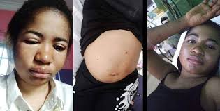 According to died in an abuja hospital today april 21. Comedian Ada Jesus Rushed To The Hospital Diagnosed With Kidney Problem