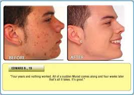 Gesund, günstig und garantiert natürlich: Mit selbstgemachter Kosmetik die  Haut verwöhnen