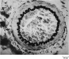 Image result for Moon White 1980 ABB Comeng