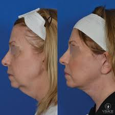 TOP 10 BEST Facial Plastic Surgeon near Oconomowoc, WI