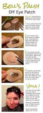 Easy Diy Eye Patch For Protecting Your Eye And Still Seeing Where You Re Going When You Have Bell S Palsy Bells Palsy Eyepatch Bell S Palsy